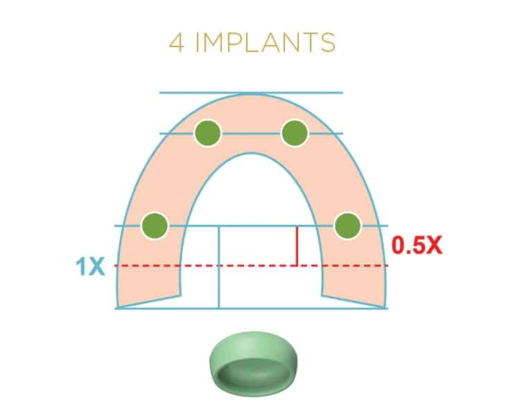 Locator Fixed® Processing Package Green x 1 – Image 2
